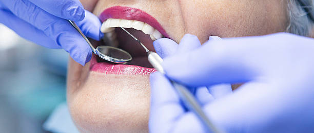 Best Teeth Whitening  in Gibbon, NE